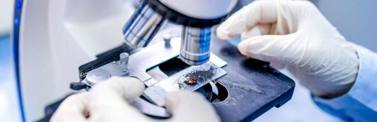 Гострі кишкові інфекції: чого остерігатися буковинцям