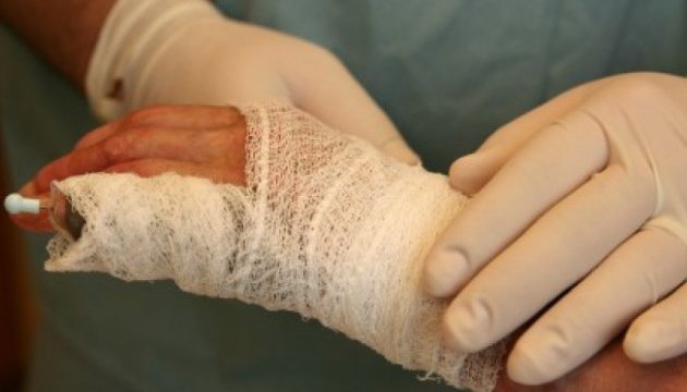 Як надати домедичну допомогу у разі термічних опіків: роз’яснення МОЗ