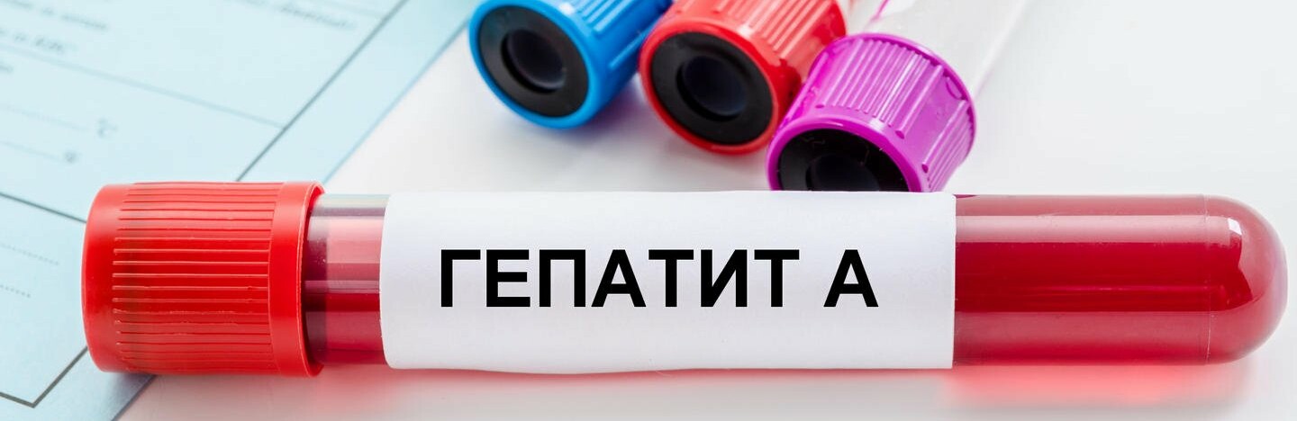 Спалах гепатиту А: чи є ризики для Чернівецької області