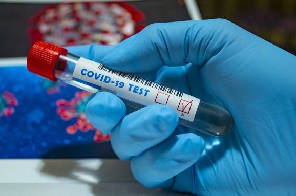 У Вашківцях Вижницького району голова ОТГ захворів на коронавірус