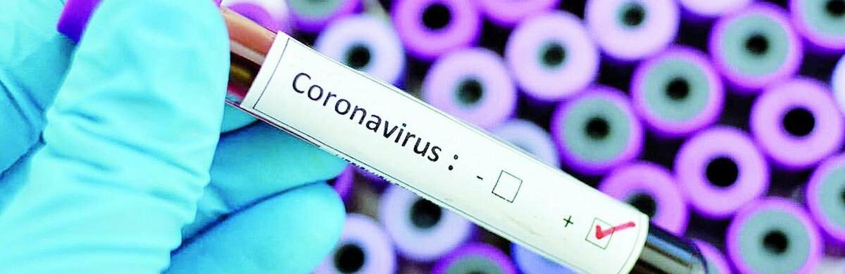 Майже три сотні: нові випадки інфікування Covid-19 на Буковині