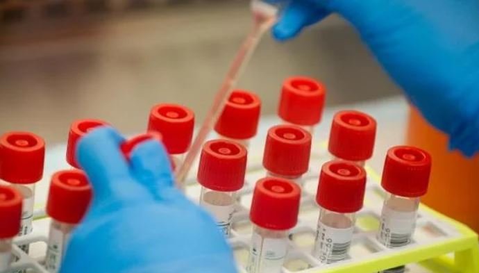 На Буковині хворі із симптомами ГРЗ можуть безкоштовно пройти ПЛР-тестування