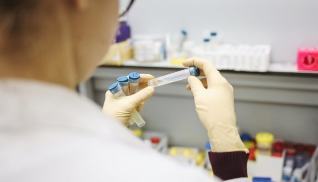 НСЗУ оновило алгоритм тестування на COVID-19: до чоту тут первинка?
