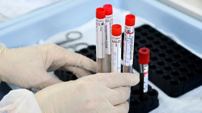 Чи є антитіла до COVID-19 після щеплення: українські науковці розробили нову тест-систему 