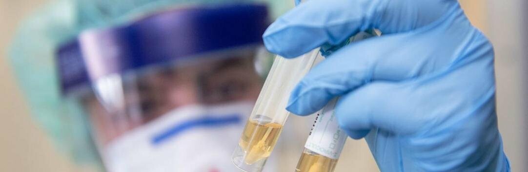 Чернівці серед лідерів: географія поширення COVID-19 в області