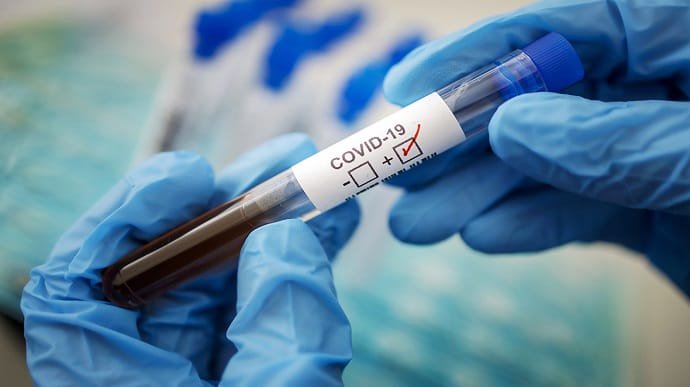 На Буковині знижується число госпіталізацій через COVID-19, але смертність досі висока