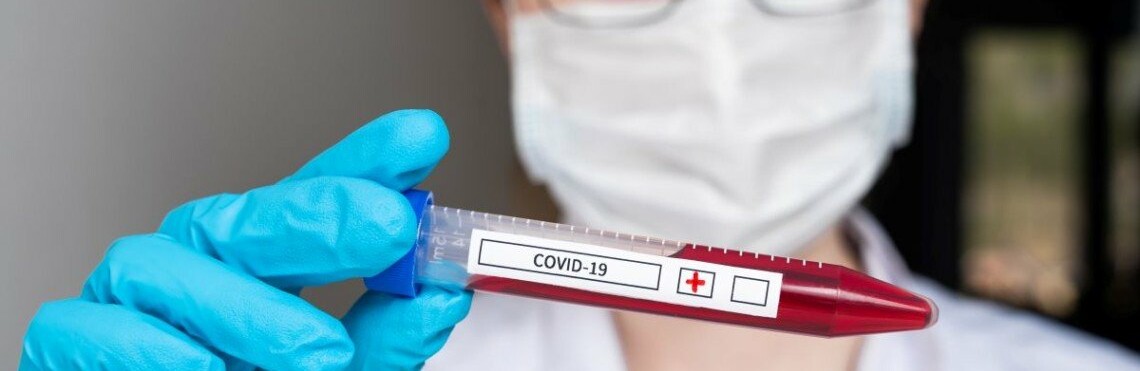 В Україні зафіксовано 2 758 нових випадків коронавірусної хвороби COVID-19, за минулу добу