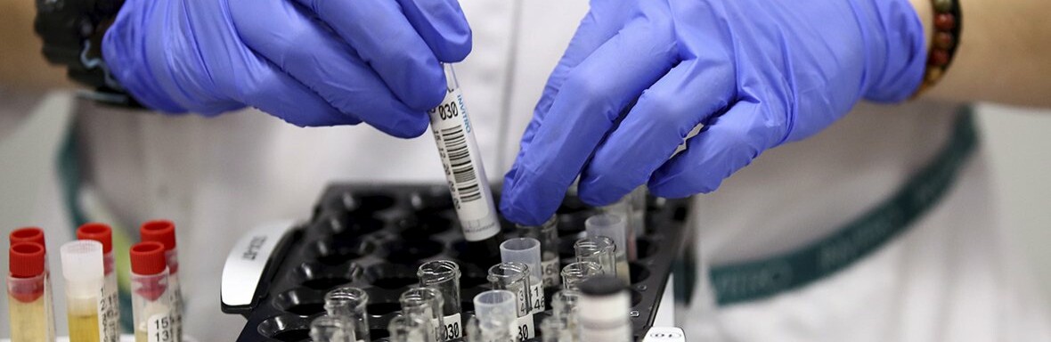 Де зафіксували нові випадки коронавірусу на Буковині минулої доби